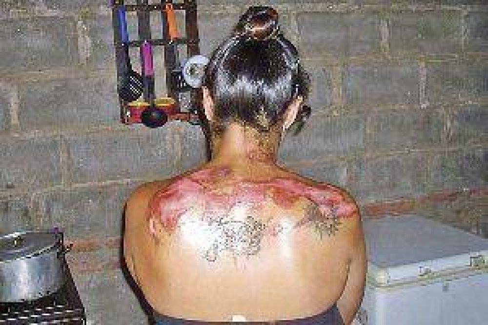 Atac� a su pareja, la roci� con alcohol y le prendi� fuego