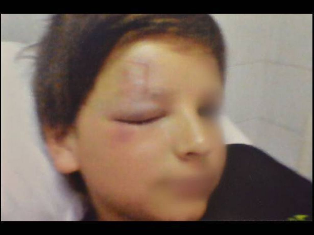 Un ni�o fue agredido en el viaje de estudios y termin� en terapia