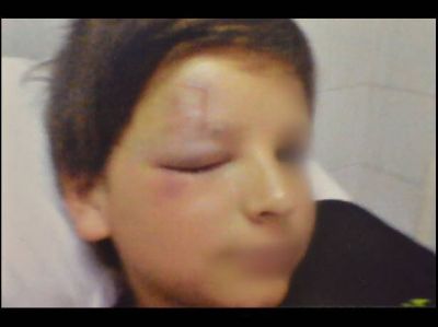 Un ni�o fue agredido en el viaje de estudios y termin� en terapia