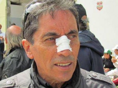 Agredieron al Secretario Gremial de Pasteleros en la empresa Tapamar