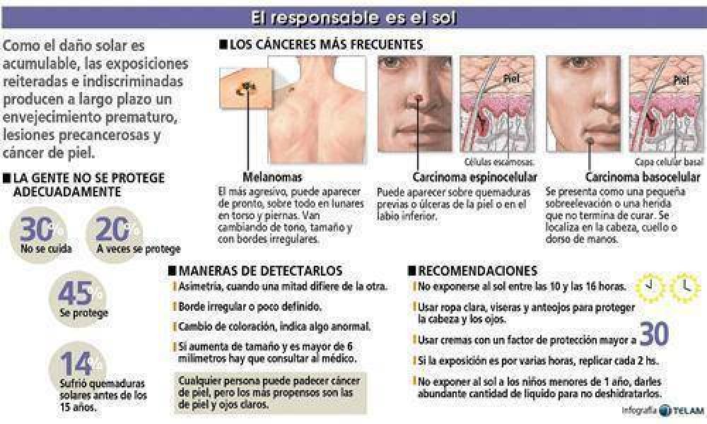 �El c�ncer de piel es el que m�s se multiplic� en los �ltimos a�os�