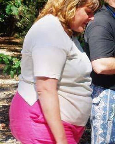 Plan para la atenci�n de personas obesas se brinda por la web