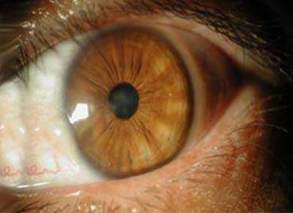 Uno de cada cuatro diab�ticos padece alguna forma de retinopat�a 