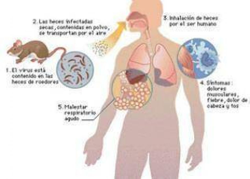 Hantavirus en Jujuy: Hubo nueve casos de hantavirus pero se detectaron a tiempo.