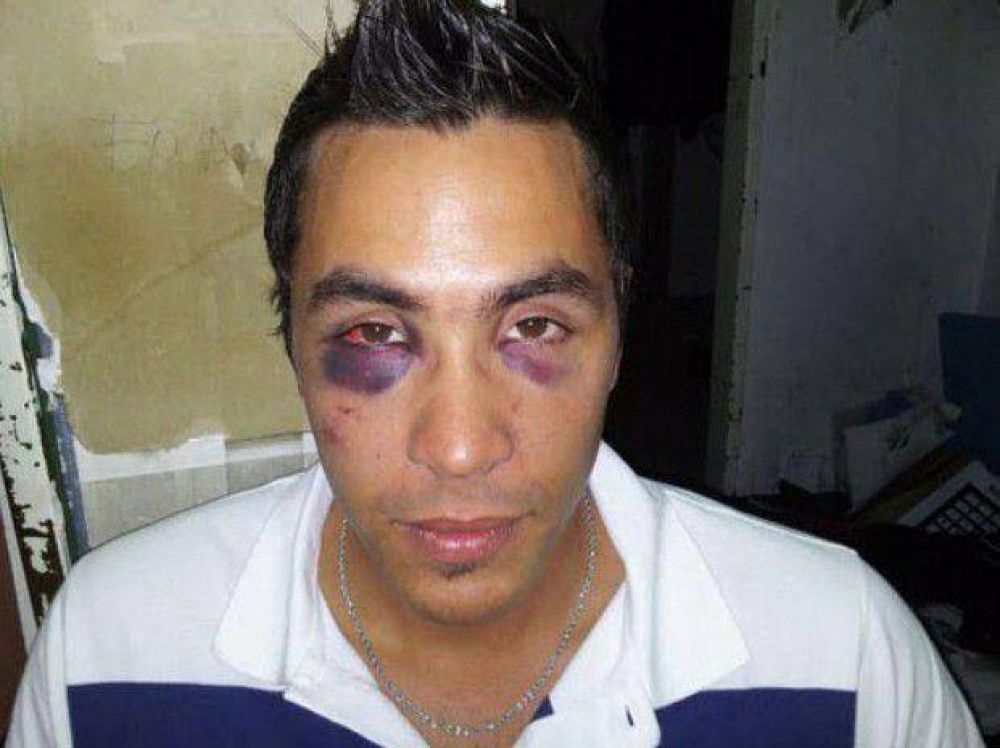 Casilda: patovicas le dieron una brutal golpiza a un joven de Correa