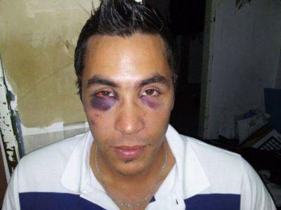 Casilda: patovicas le dieron una brutal golpiza a un joven de Correa