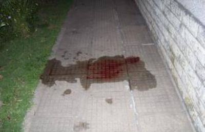 Brutal ataque a joven por robo