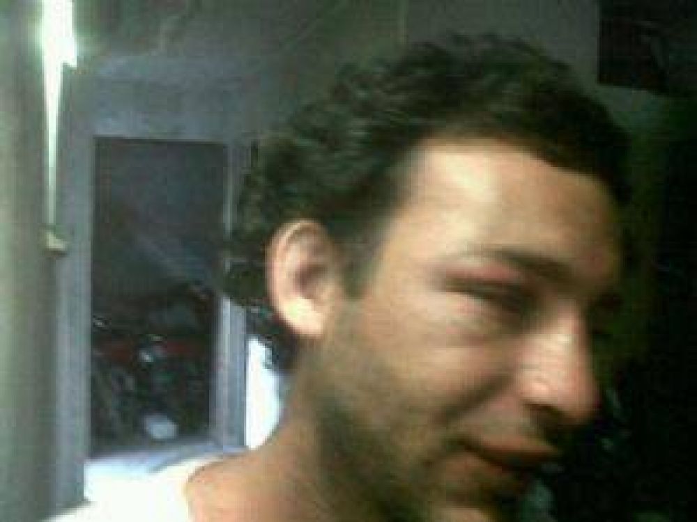 Joven denunci� que polic�as lo golpearon salvajemente