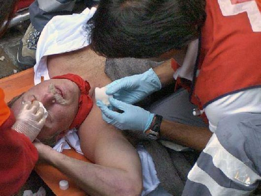 Disminuy� la cantidad de heridos por pirotecnia