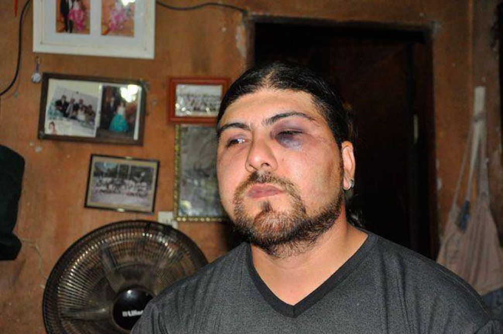Brutal golpiza policial a un joven que escap� con su moto: los vecinos fueron testigos del ataque 