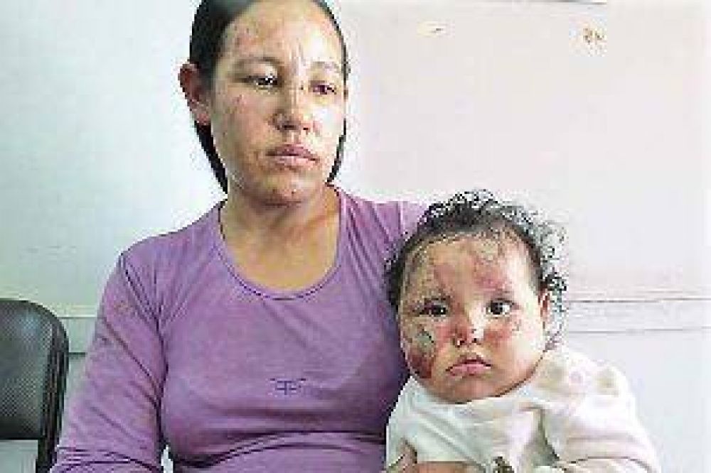 "Pens� que mi nena estaba muerta", expres� la madre arrojada desde una moto