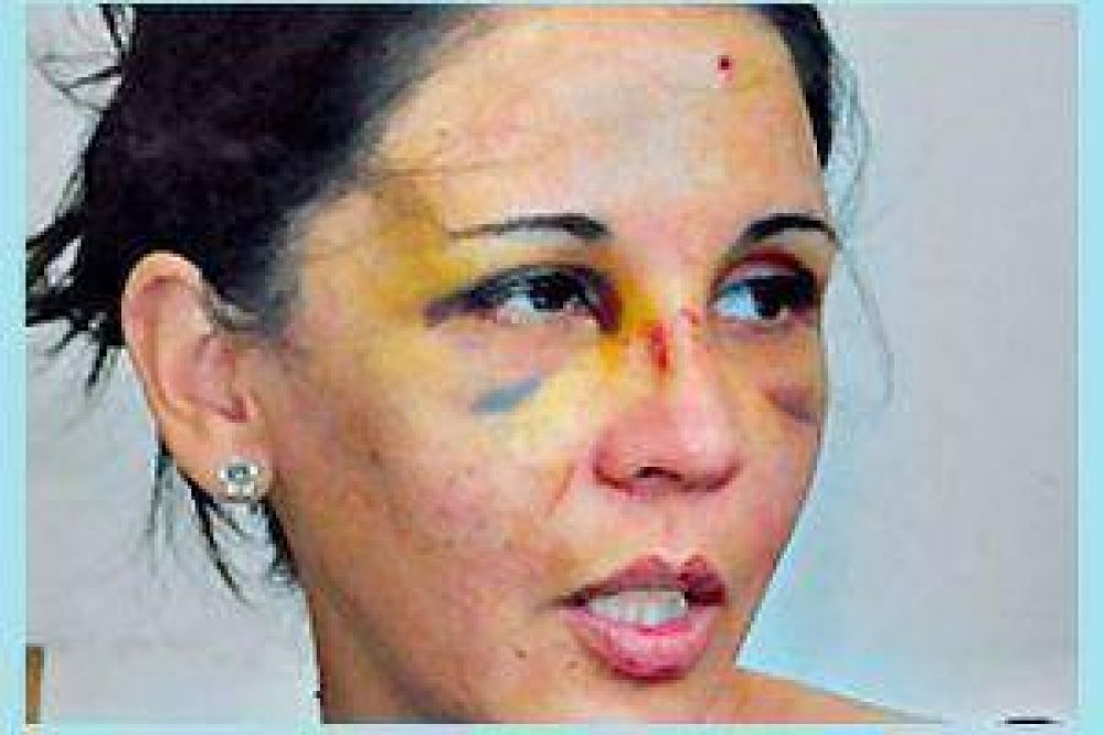 Detienen a prosecretario del Concejo Deliberante por salvaje agresi�n a una mujer en su propia casa