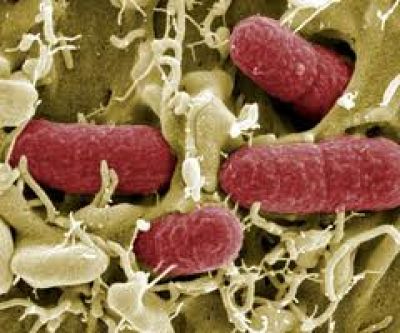 S�ndrome Ur�mico Hemol�tico: primer caso del a�o en Bah�a Blanca	