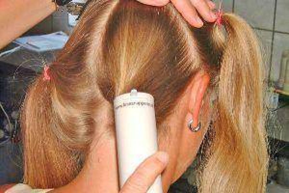 Advierten sobre proliferaci�n de piojos durante el verano 