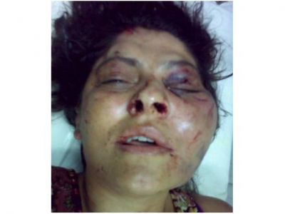 El dram�tico relato de Laura Girala, la mujer golpeada por su ex pareja
