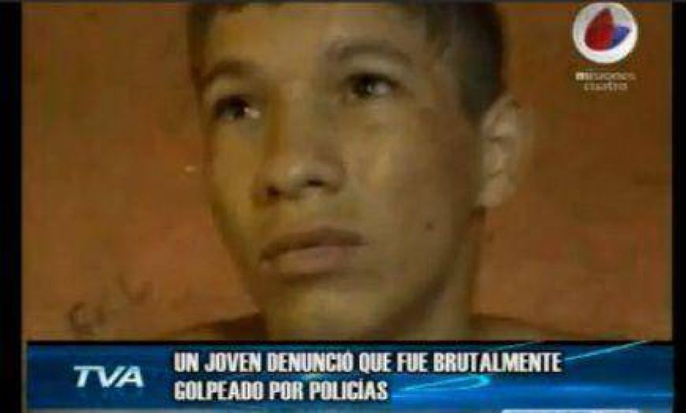 Joven denunci� que fue golpeado por polic�as alcoholizados