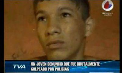 Joven denunci� que fue golpeado por polic�as alcoholizados