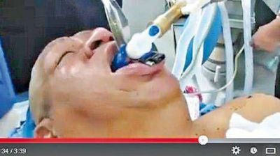 Un diario espa�ol difundi� una foto de Ch�vez entubado, pero era falsa