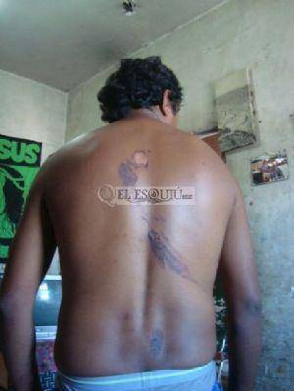 Denuncian a polic�as por quemar a un joven con agua hirviendo
