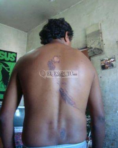 Denuncian a polic�as por quemar a un joven con agua hirviendo