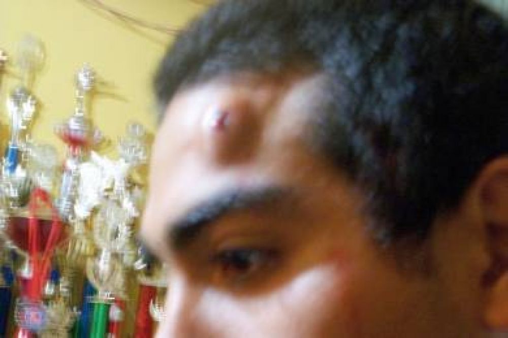 Denuncian violenta represi�n policial en la avenida Lisandro de la Torre