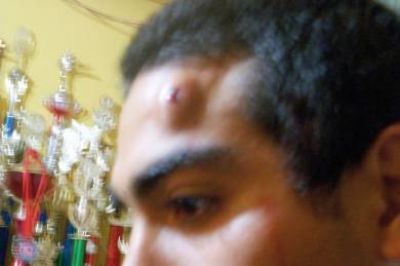 Denuncian violenta represi�n policial en la avenida Lisandro de la Torre
