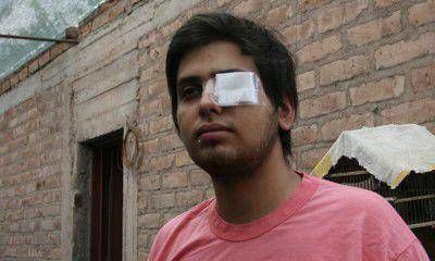 Podr�a perder un ojo tras recibir un disparo cuando sacaba la entrada para el River-Boca