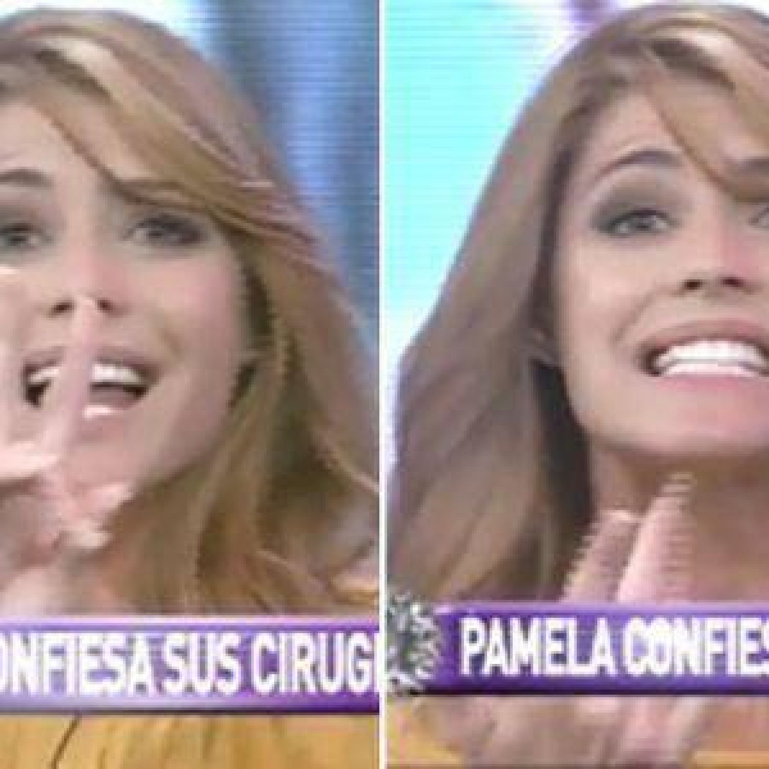 Pamela David contó cuáles fueron sus siete cirugías