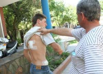 Le roban el casco y le dan 2 cuchillazos por ir a reclamarlo