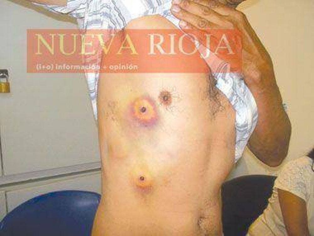 Un hombre denunci� que polic�as ingresaron a su casa y lo balearon