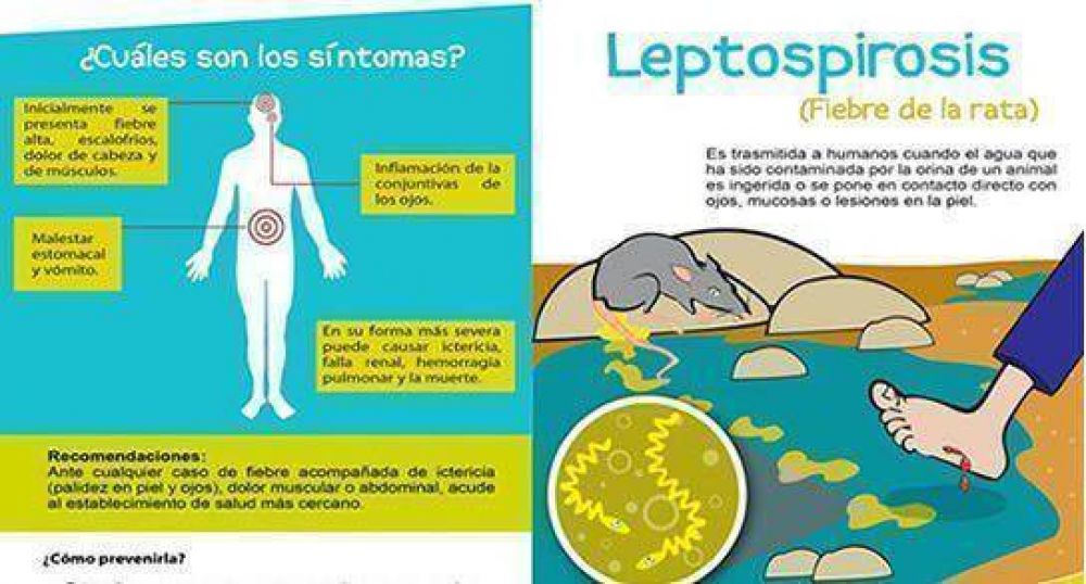 Caso fatal de Leptospirosis en Santa Fe