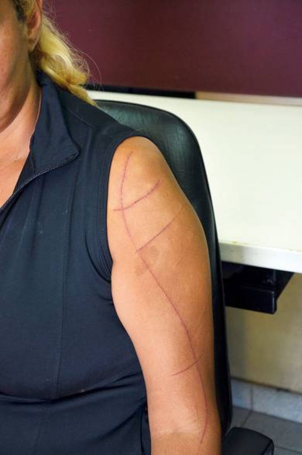 Mujer denuncia que fue cortada por su pareja
