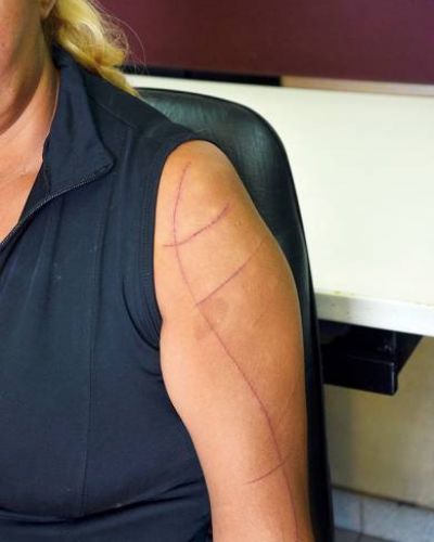 Mujer denuncia que fue cortada por su pareja