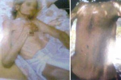 Detuvieron a una mujer por las aberrantes condiciones en las que manten�a a sus padres
