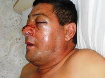 Preocupa a la Polic�a el ataque a efectivos
