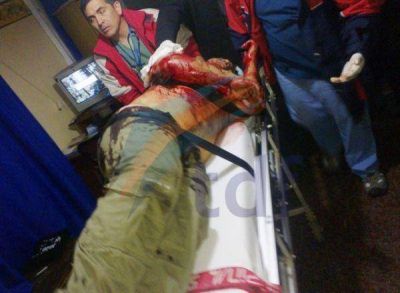 Dos hermanos protagonizaron violenta pelea y uno de ellos termin� apu�alado