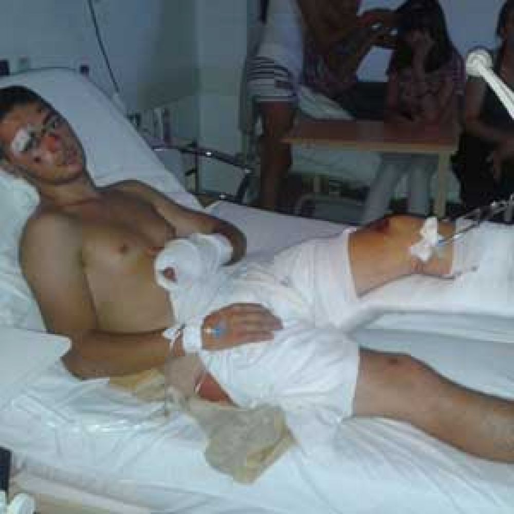 Denuncian que patrullero sin luces y en contramano atropell� a un joven