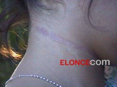 Intento de homicidio: La mujer hallada colgada en Oro Verde cont� el drama que est� viviendo 