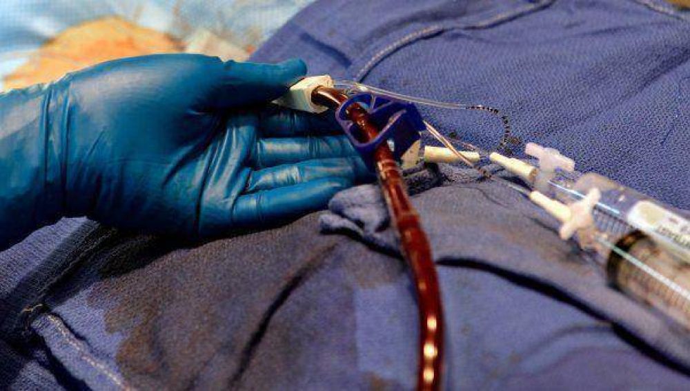 Se contagi� HIV durante una transfusi�n