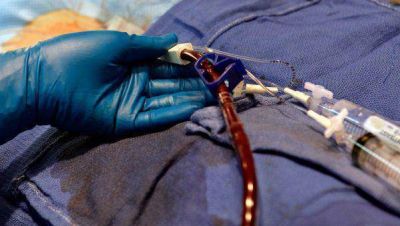 Se contagi� HIV durante una transfusi�n