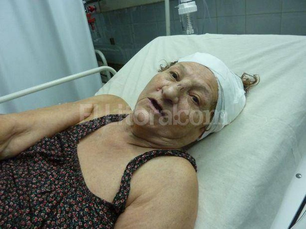 Madre e hija heridas en un asalto