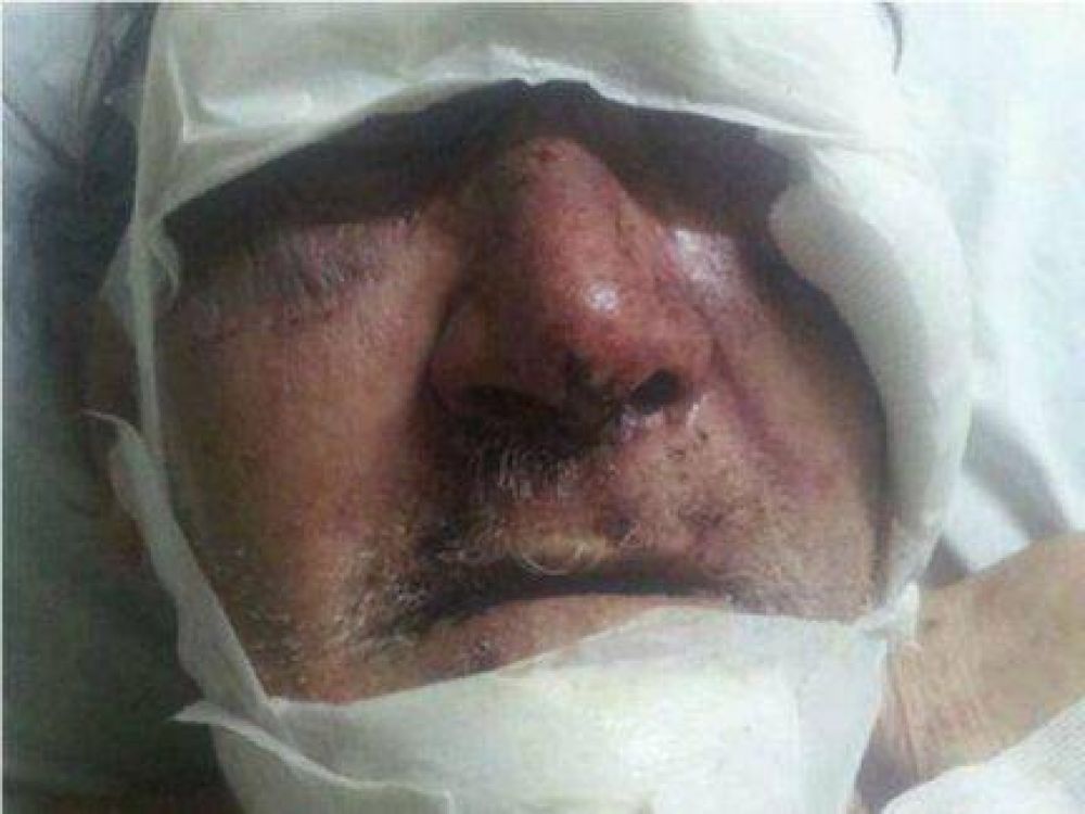 Anciano asaltado y agredido por joven linchado est� ciego por los palazos en la cabeza 