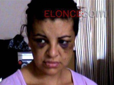Una madre denuncia que su hija es adicta y que el novio la golpe� �hasta desfigurarle el rostro� 