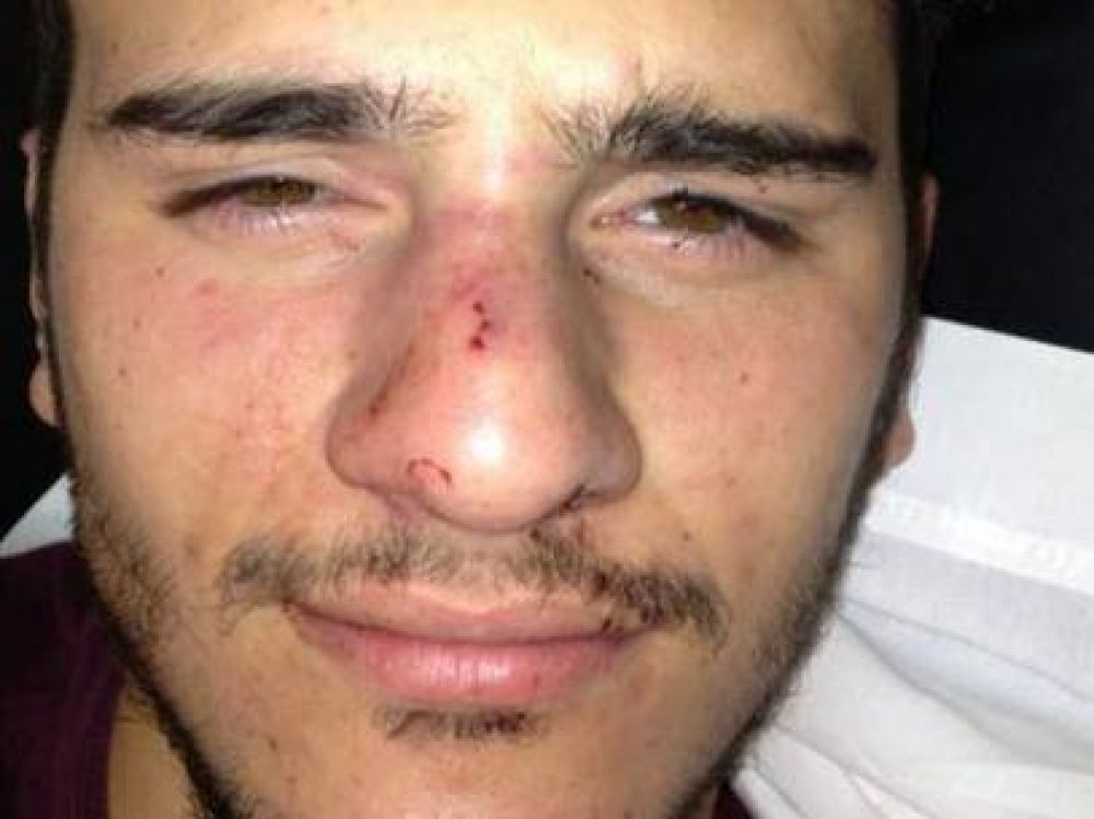 Golpiza a un joven en una fiesta en San Isidro por ser homosexual