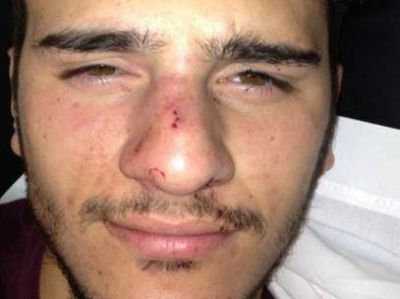 Golpiza a un joven en una fiesta en San Isidro por ser homosexual
