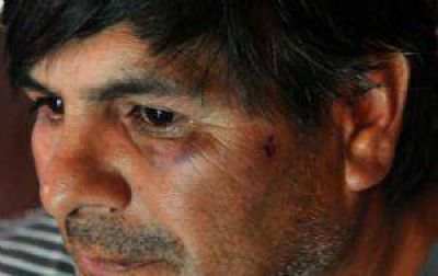Denuncian golpiza de polic�as en Guti�rrez