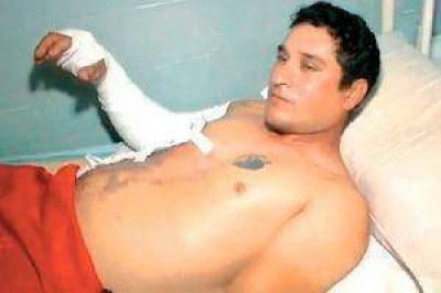 "Sent� un fogonazo, me despert� y estaba envuelto en llamas"