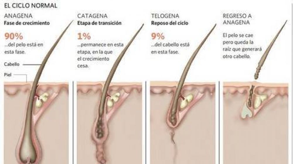 Asocian la calvicie masculina con problemas card�acos