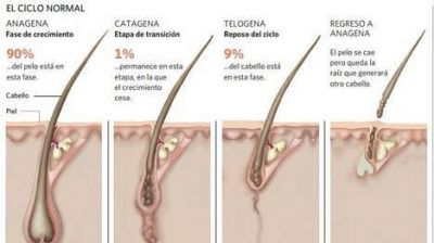 Asocian la calvicie masculina con problemas card�acos