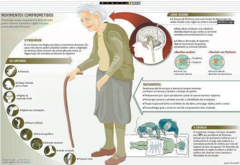 Buscan formar grupos de asistencia a pacientes que padecen Parkinson